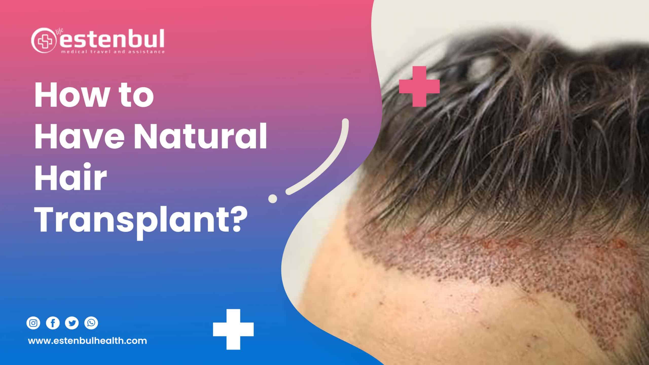 How To Have Natural Hair Transplant Estenbul Health