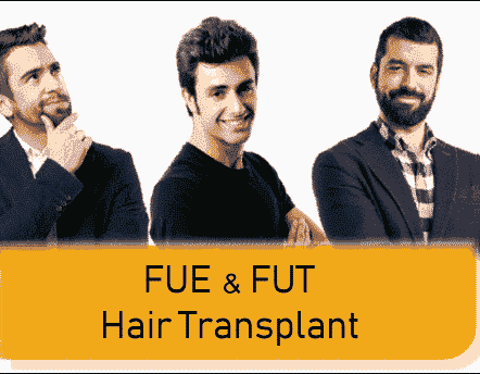 FUE and FUT Hair Transplant Skills Differences