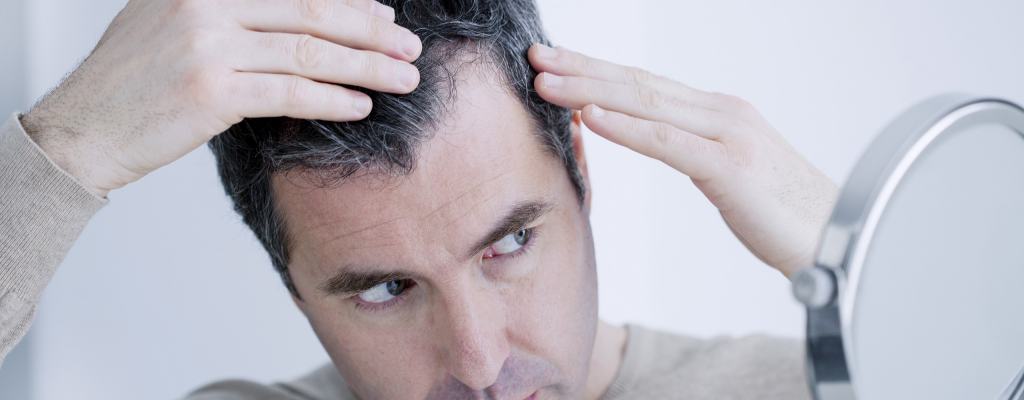 Hair Transplant: 10 Things to Consider Before You Decide