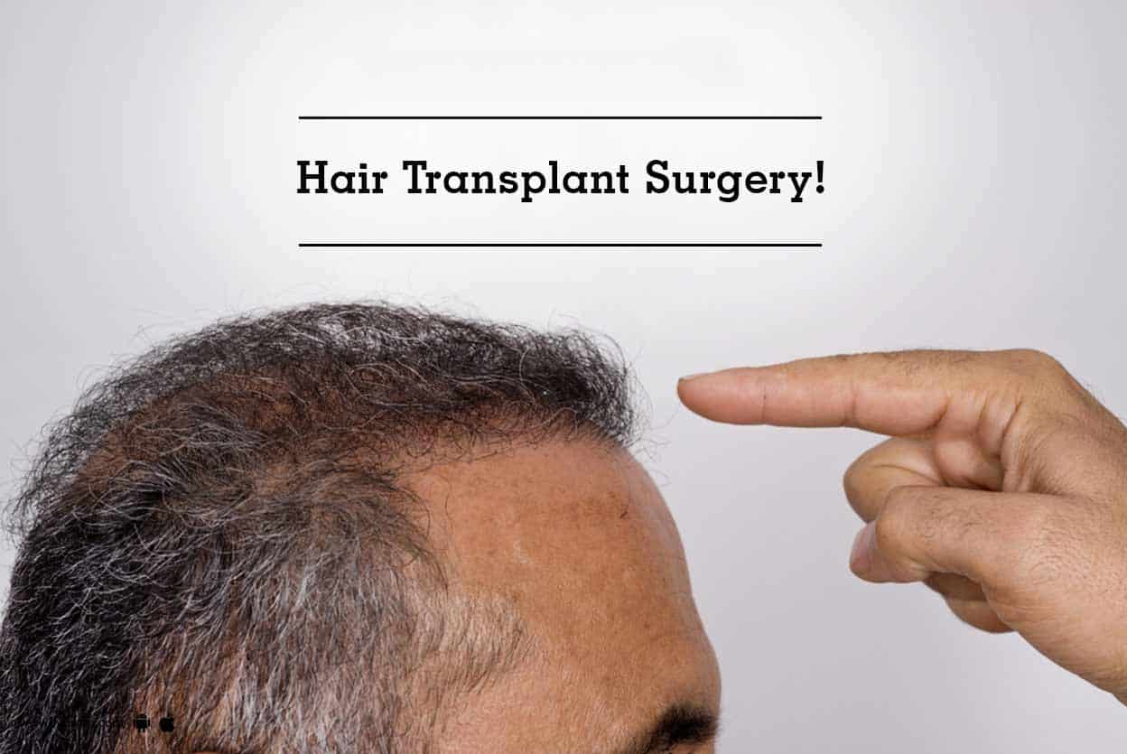 Hair Transplant Surgery: Do You Need It?