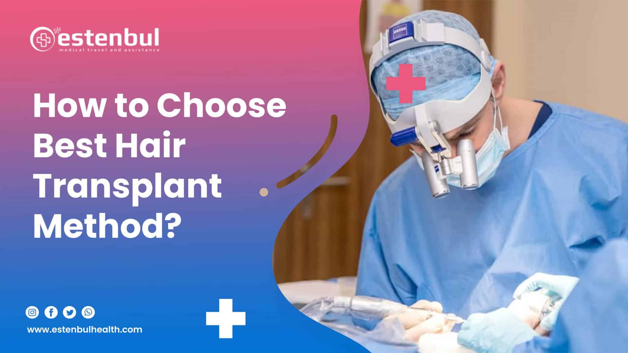 How to Choose Best Hair Transplant Method? Estenbul Health