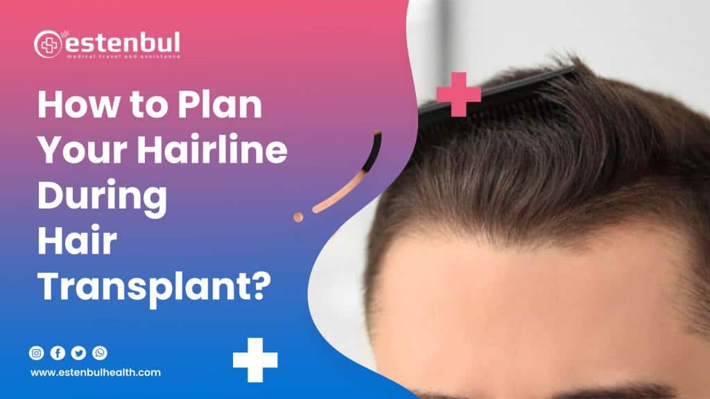 How to Plan Your Hairline During Hair Transplant?