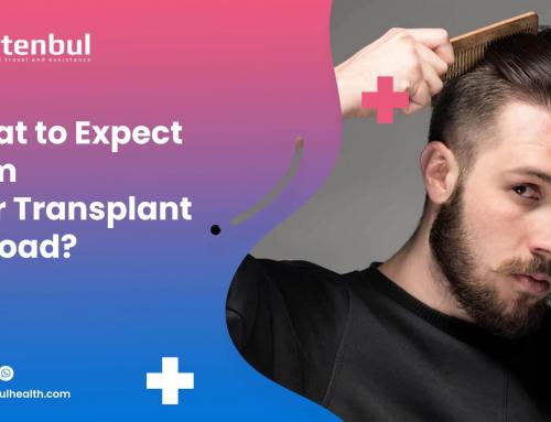 What to Expect from Hair Transplant Abroad