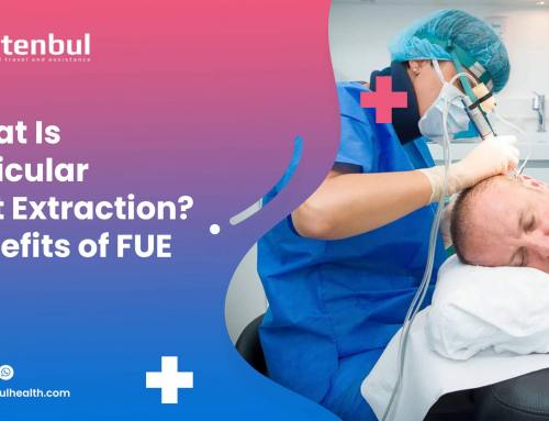 What Is Follicular Unit Extraction? Benefits of FUE