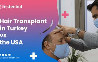 hair transplant in turkey vs usa