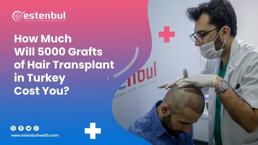 hair transplant in turkey cost