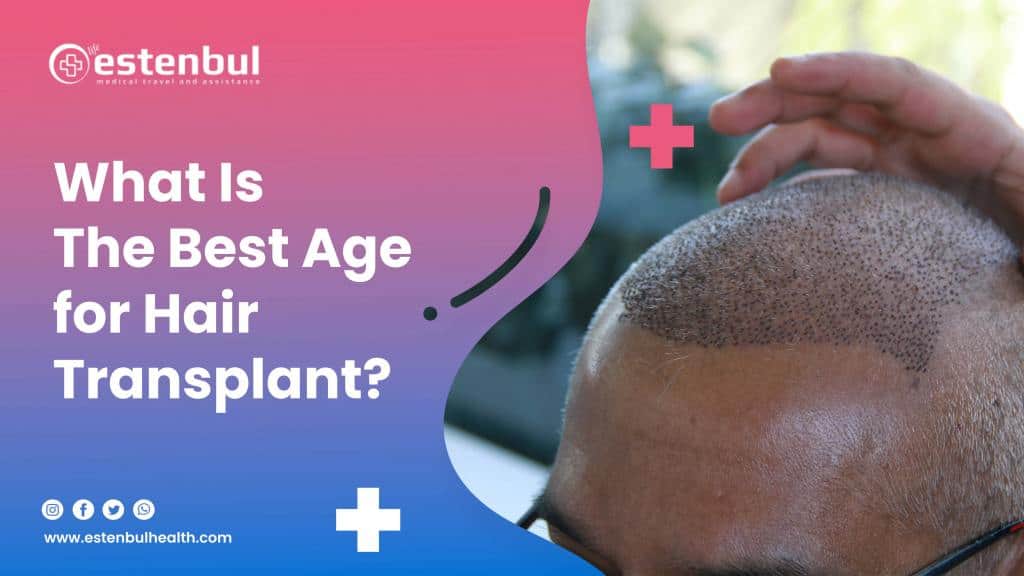What Is The Best Age for Hair Transplant