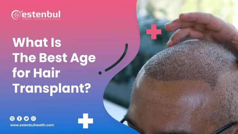 what-is-the-best-age-for-hair-transplant-estenbul-health