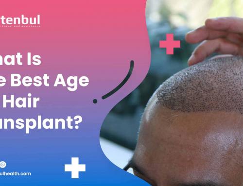 What Is The Best Age for Hair Transplant?