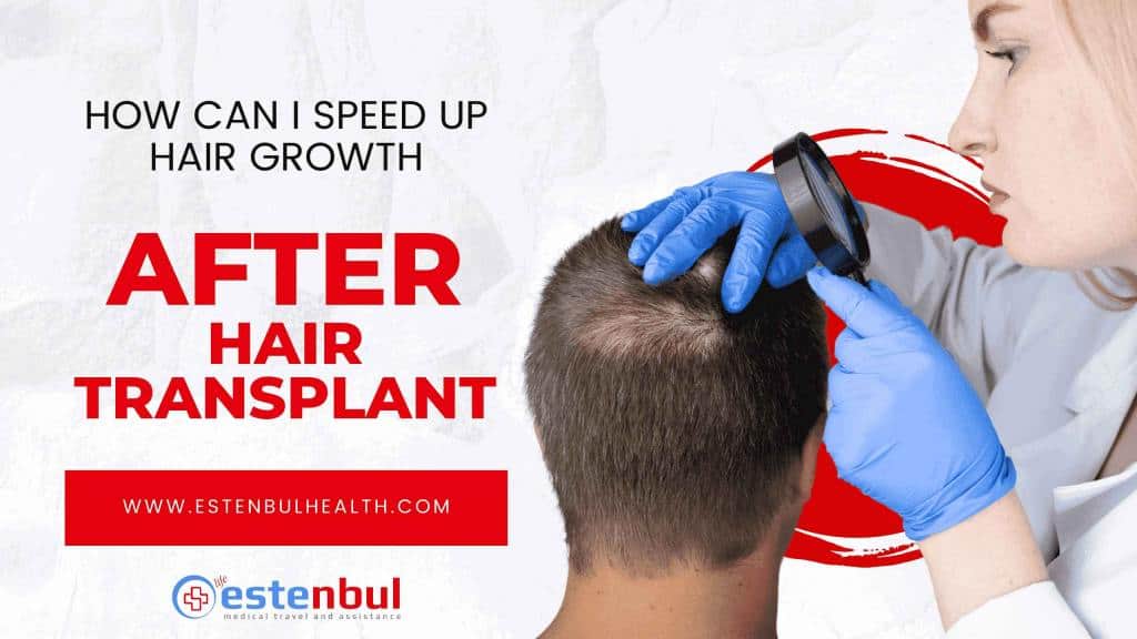 How Can I Speed Up After Hair Transplant?