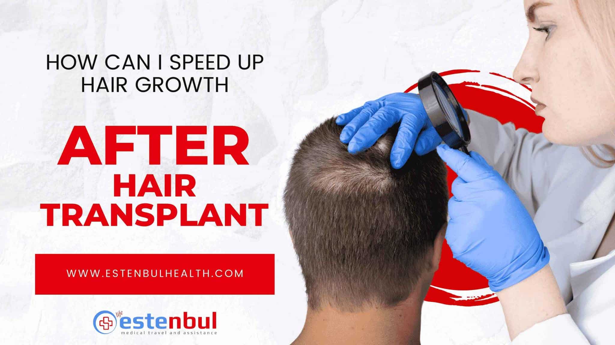 How Can I Speed Up Hair Growth? Estenbul Health