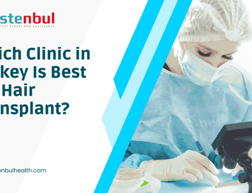 Which Clinic in Turkey Is Best for Hair Transplant on 2022?