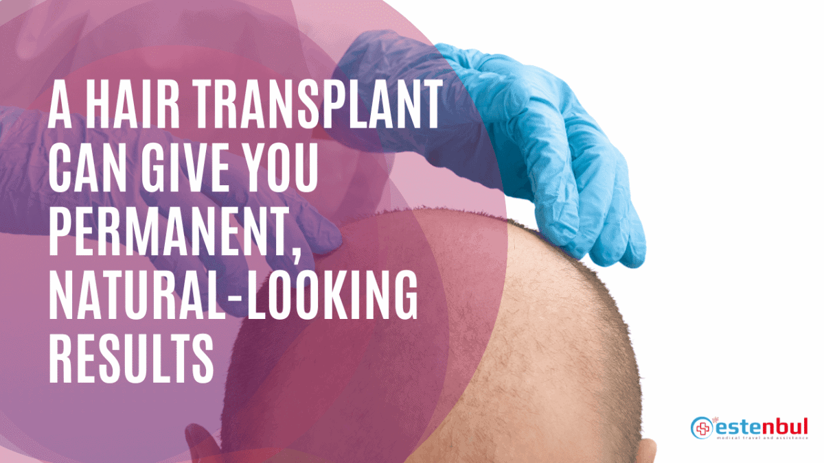 A Hair Transplant Can Give You Permanent Result Estenbul Health