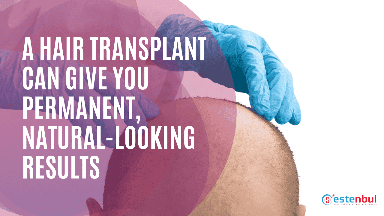 A Hair Transplant Can Give You Permanent, Natural-Looking Results