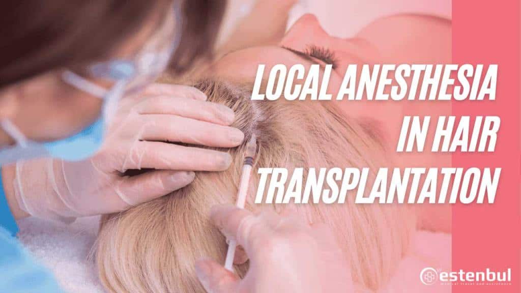 Local Anesthesia in Hair Transplantation
