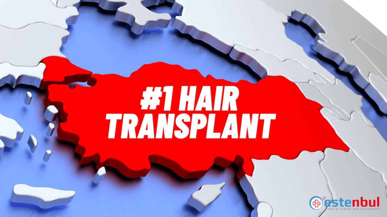 Best Country for Hair Transplant on the World