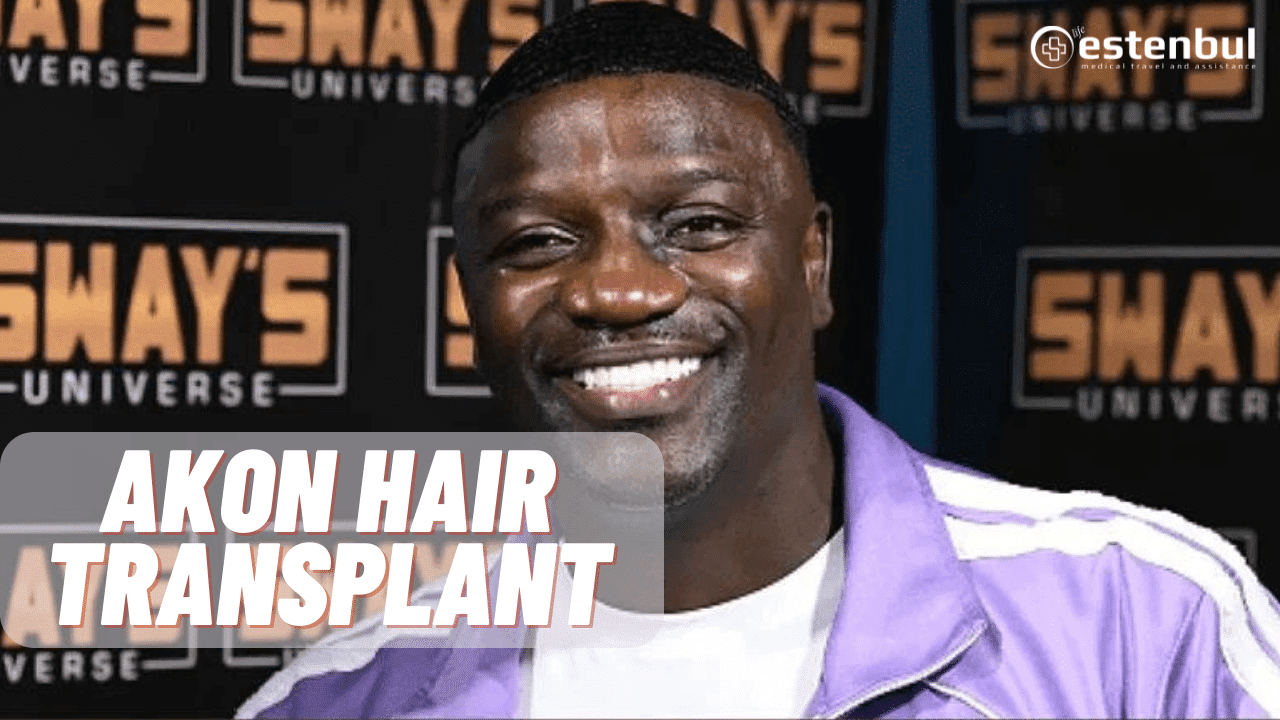 Akon Hair Transplant in Turkey