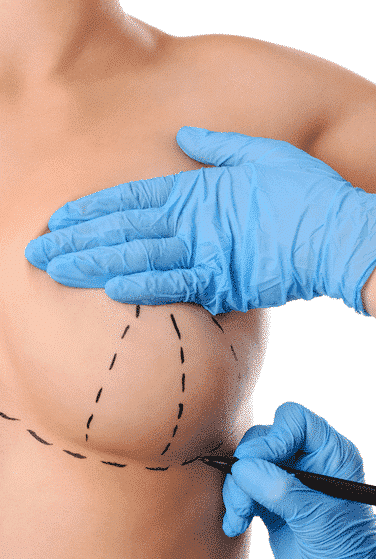 Breast Uplift Surgery in Turkey