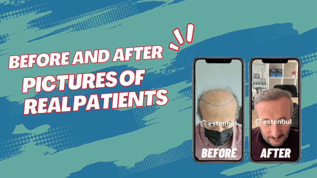 Before and After Pictures of Real Patients