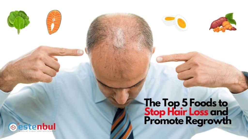 The Top 5 Foods to Stop Hair Loss and Promote Regrowth