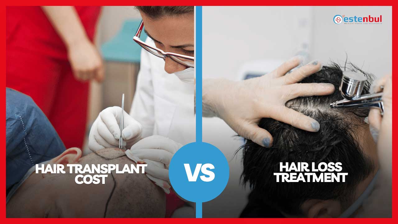 Hair Transplant Cost vs. Hair Loss Treatments