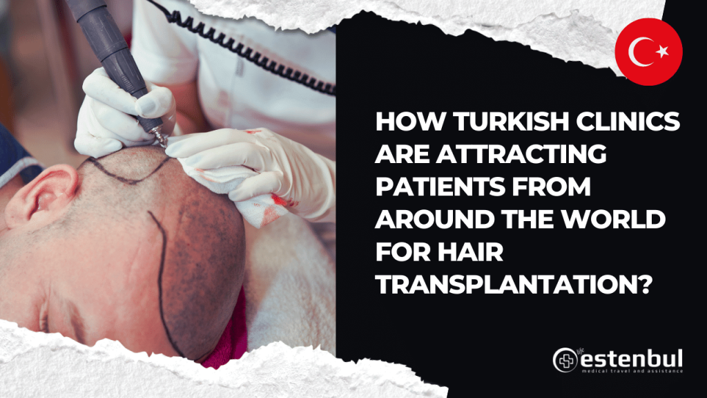 Patients from Around the World for Hair Transplantation