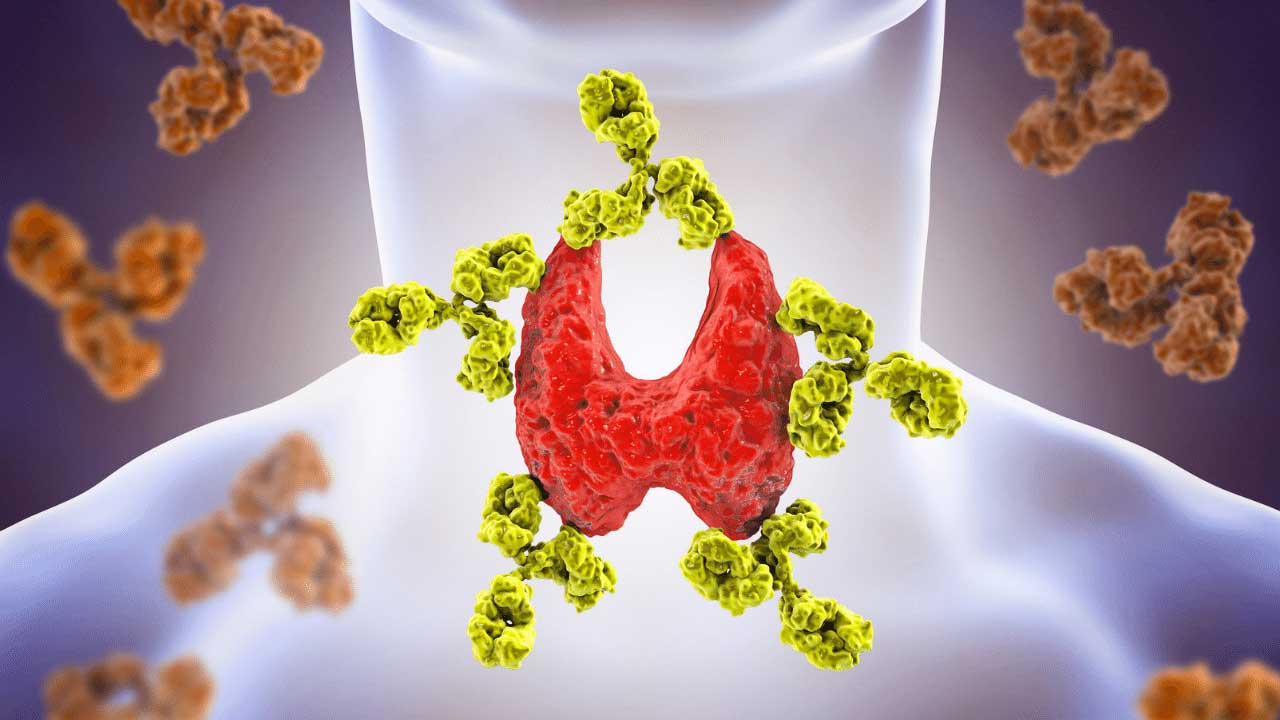 The Link Between Thyroid Disorders and Hair Loss | Estenbul Health