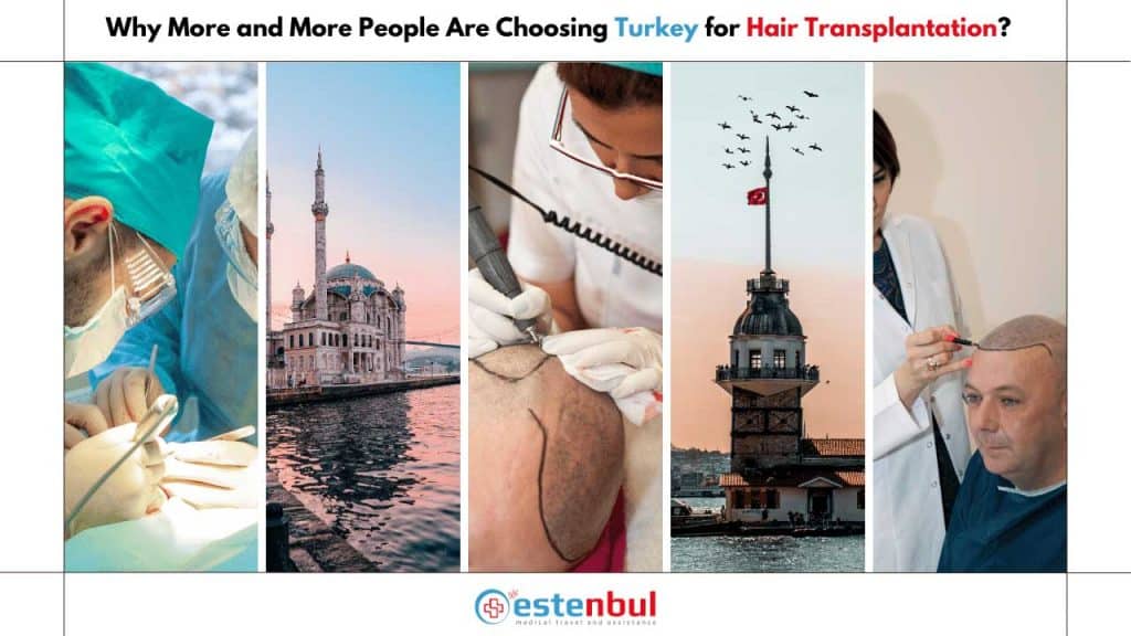 Why More and More People Are Choosing Turkey for Hair Transplantation