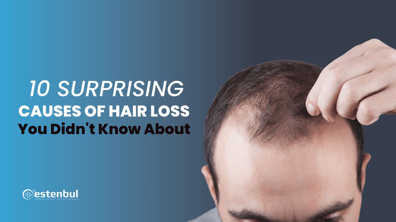 10 Surprising Causes of Hair Loss You Didn't Know About