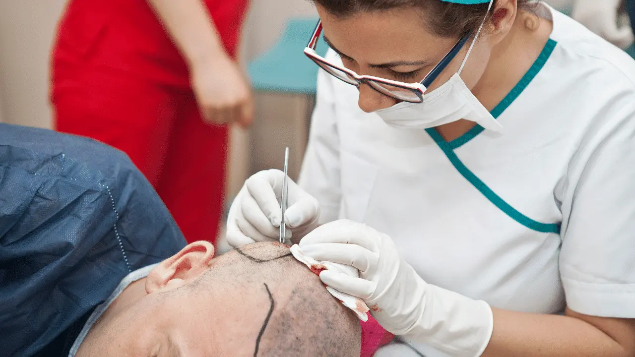 the pros and cons of hair transplant in turkey
