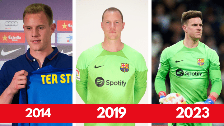Ter stegen hair loss and hair transplant journey in 9 years
