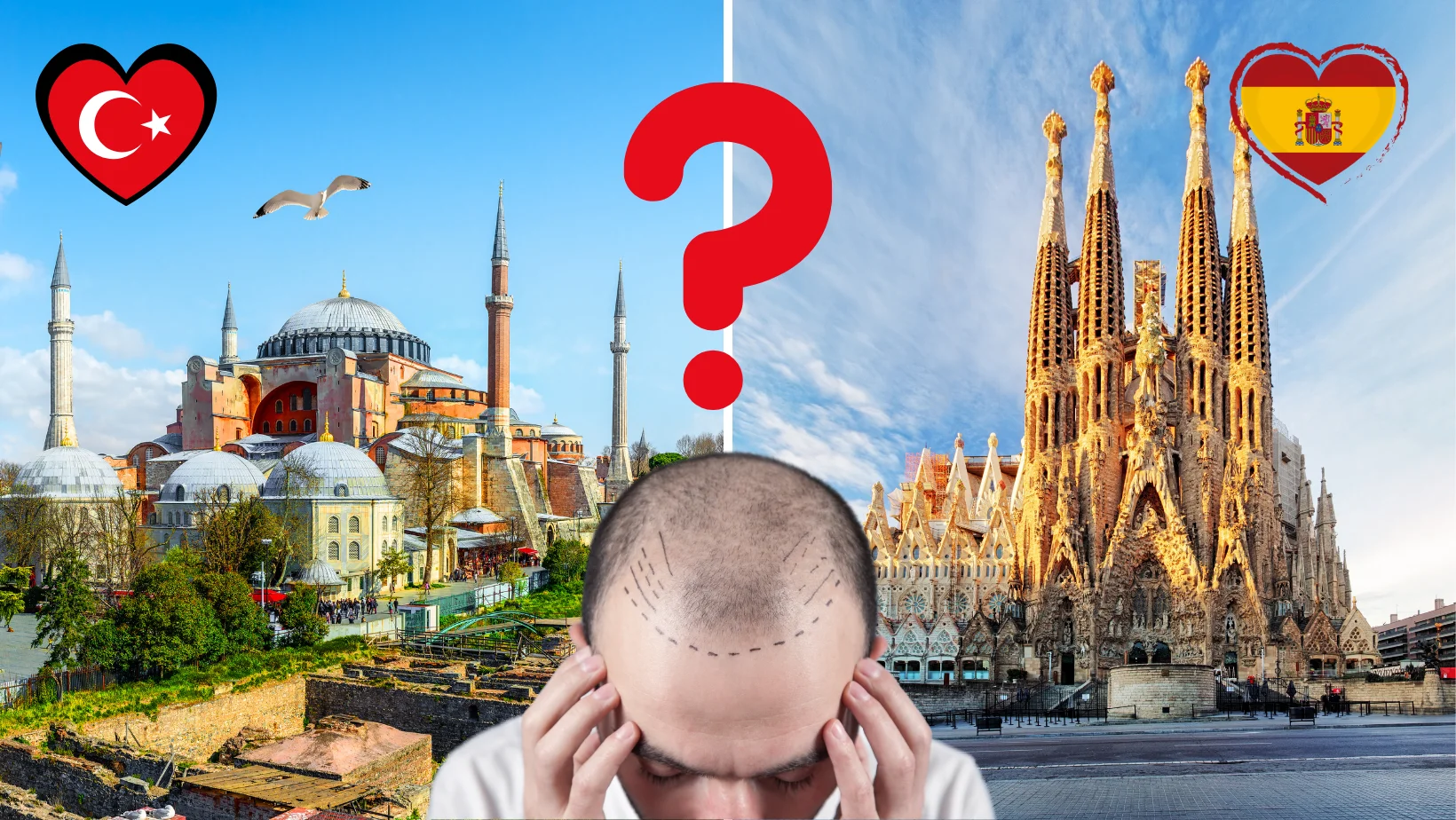 Turquía y España: ¿Por qué Elegir Turquía para un Trasplante de Cabello?