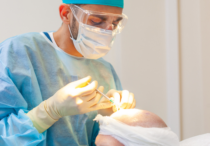 get your hair transplant surgery