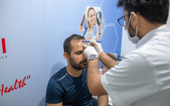 hair transplant consultation