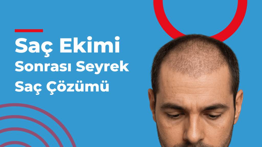 Saç ekimi sonrası yeni çıkan saçların seyrek görünümünü gösteren erkek başı yakın çekim fotoğrafı, saç çizgisi ve ekim alanı detayları