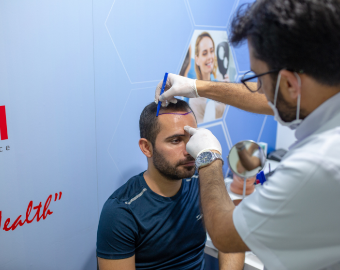 Hair Transplant in Turkey with Estenbul Health
